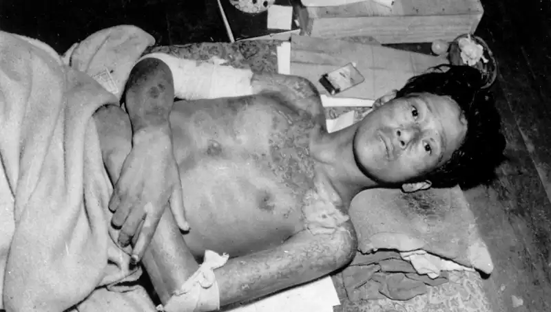 80 Yıl Sonra Nagasaki’den Sarsıcı Uyarı: Nükleer Felaket Kapıda mı?